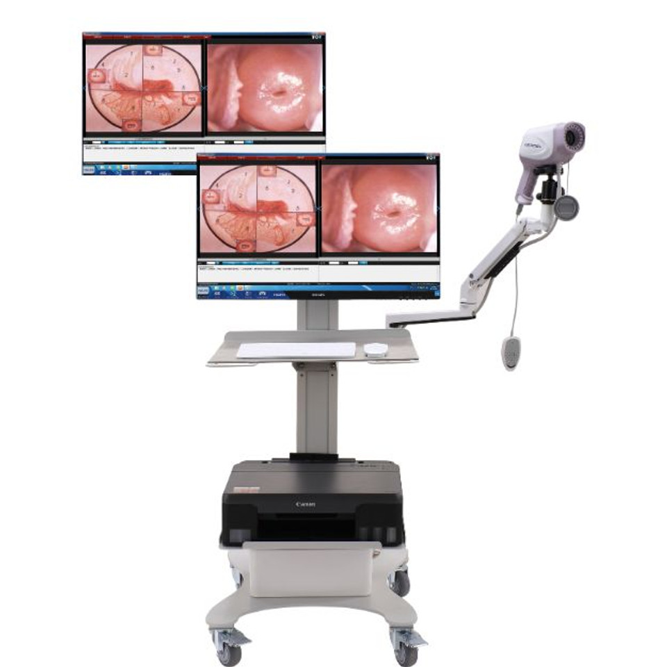 Kernel CE ISO 4K Ready HD Digi - đánh giá và giá Women'S Health & Wellness Center